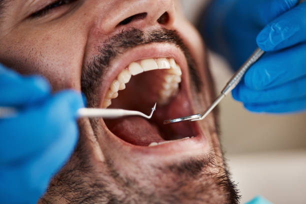 Best Emergency Root Canal Treatment in Battle Creek, NE